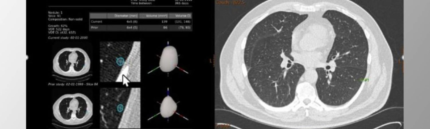 TMC secure even higher radiology quality with now 4 implemented AI solutions