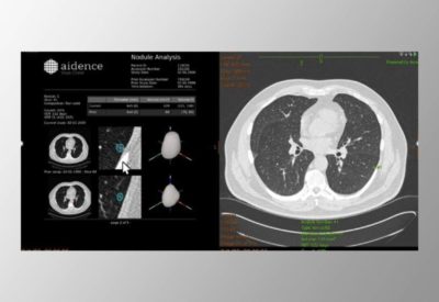 TMC secure even higher radiology quality with now 4 implemented AI solutions