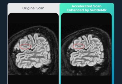 Unilabs Sweden Launches Subtle Medical’s AI-powered Imaging Technology to Further Bolster Patient Care