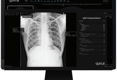 Unilabs signs on Qure.ai for triaging chest X-rays